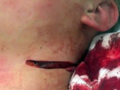ÚTOK NOŽOM V POĽSKEJ ŠKOLE: Hlásia najmenej osem zranených